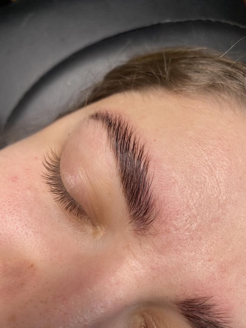 Brow lift sans épilation